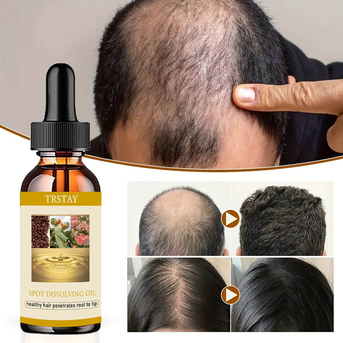 50ML Beard Growth Oil Anti Alo - Beard Oil recension och pris
